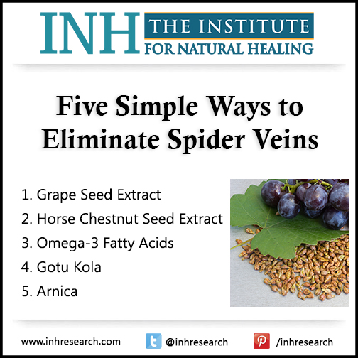 They aren’t just embarrassing… Spider veins could be the first sign of a bigger, more dangerous problem. Here are five easy ways to get rid of them.