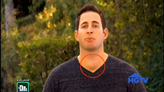 After doctors brushed him off, it was a fan’s email that led HGTV star Tarek El Moussa to his thyroid cancer diagnosis. Here’s how to protect your thyroid from cancer. 