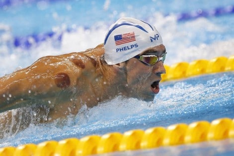 Michael Phelps sports cupping marks on his shoulders