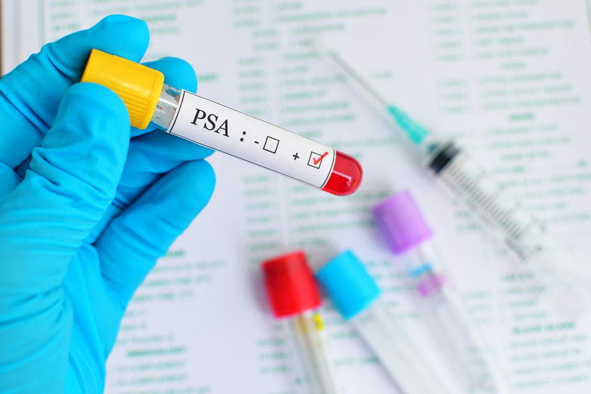 A new Harvard study claims the PSA test predicts which men will get a deadly form of prostate cancer. Don’t fall for it. There’s a better screening on the market.