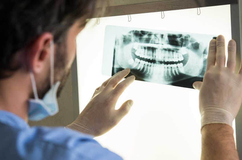 Getting annual dental X-rays is like putting a ticking time bomb in your brain.
