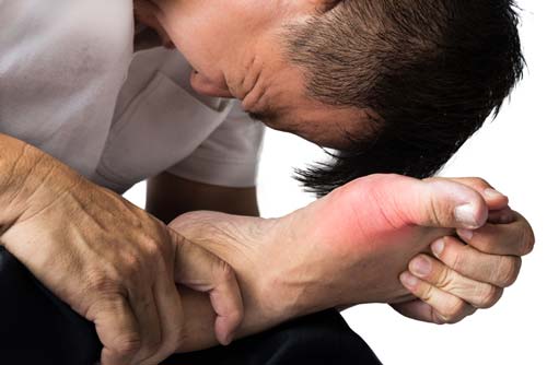 Painful Gout