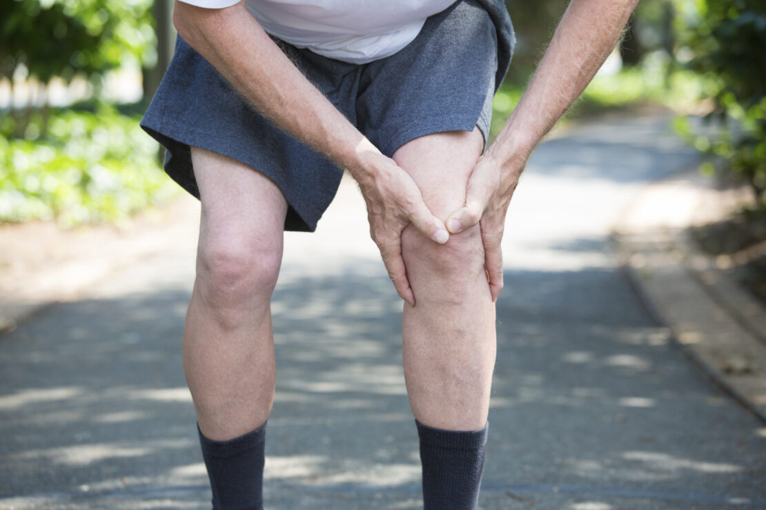 Photo of aching knees.