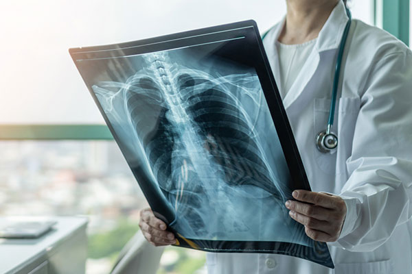 Photo of Doctor holding x-ray.