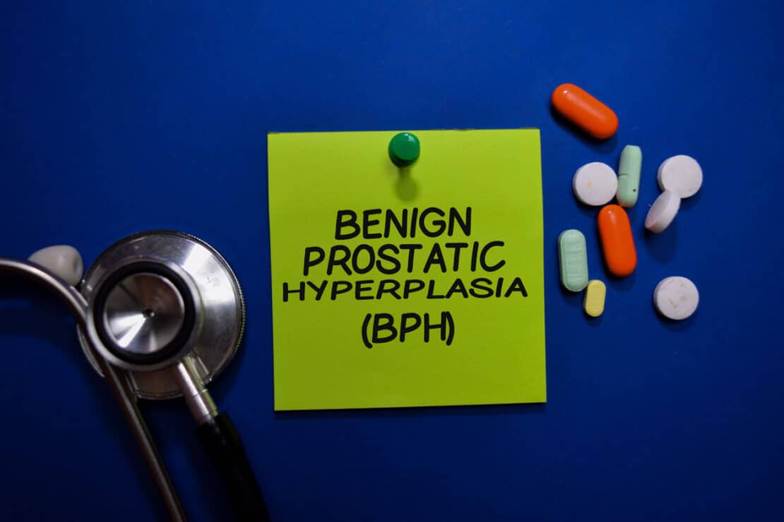 Benign Prostatic Hyperplasia (BPH) write on sticky note isolated on Office Desk. Healthcare or Medical Concept stock photo